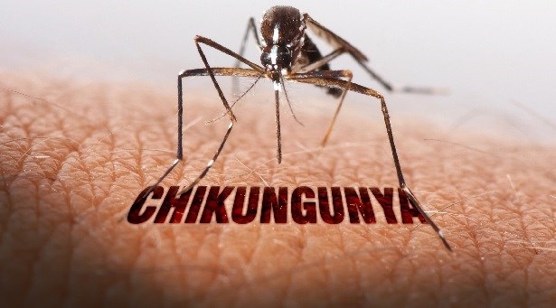 chikungunya